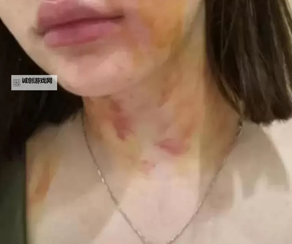 自贡女子遭夫妻两人殴打扒衣事件引发关注图1